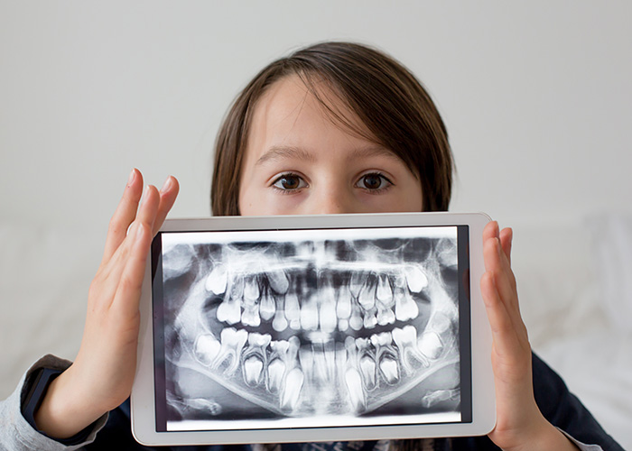 Shalom Blobstein, DMD, PLLC | Exams   Cleanings, Pediatric Dentistry and Baby Molar Crowns